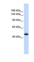 GREB1 Antibody - GREB1 antibody Western blot of Fetal Brain lysate. This image was taken for the unconjugated form of this product. Other forms have not been tested.