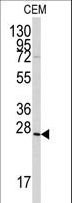 GREM1 / Gremlin-1 Antibody - Western blot of anti-Gremlin antibody in CEM cell line lysates (35 ug/lane). Gremlin (arrow) was detected using the purified antibody.