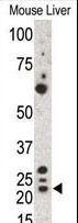 GREM1 / Gremlin-1 Antibody - Western blot of anti-Gremlin antibody in mouse liver cell lysate. Gremlin (arrow) was detected using purified antibody. Secondary HRP-anti-rabbit was used for signal visualization with chemiluminescence.