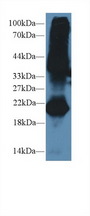 GREM1 / Gremlin-1 Antibody - Western Blot; Sample: Mouse Testis lysate; Primary Ab: 2µg/ml Rabbit Anti-Mouse GREM1 Antibody Second Ab: 0.2µg/mL HRP-Linked Caprine Anti-Rabbit IgG Polyclonal Antibody