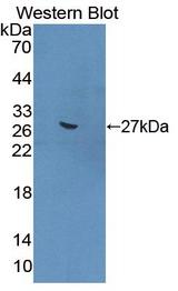 GREM1 / Gremlin-1 Antibody - Western Blot; Sample: Recombinant protein.