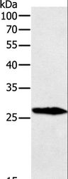 GREM1 / Gremlin-1 Antibody - Western blot analysis of Mouse testis tissue, using GREM1 Polyclonal Antibody at dilution of 1:700.