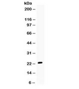 GREM1 / Gremlin-1 Antibody