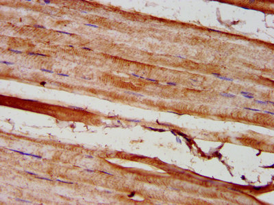 GREM1 / Gremlin-1 Antibody - Immunohistochemistry image at a dilution of 1:300 and staining in paraffin-embedded human skeletal muscle tissue performed on a Leica BondTM system. After dewaxing and hydration, antigen retrieval was mediated by high pressure in a citrate buffer (pH 6.0) . Section was blocked with 10% normal goat serum 30min at RT. Then primary antibody (1% BSA) was incubated at 4 °C overnight. The primary is detected by a biotinylated secondary antibody and visualized using an HRP conjugated SP system.