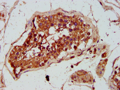 GREM1 / Gremlin-1 Antibody - Immunohistochemistry image at a dilution of 1:300 and staining in paraffin-embedded human testis tissue performed on a Leica BondTM system. After dewaxing and hydration, antigen retrieval was mediated by high pressure in a citrate buffer (pH 6.0) . Section was blocked with 10% normal goat serum 30min at RT. Then primary antibody (1% BSA) was incubated at 4 °C overnight. The primary is detected by a biotinylated secondary antibody and visualized using an HRP conjugated SP system.
