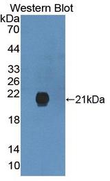 GREM2 / Gremlin 2 Antibody - Western blot of GREM2 / Gremlin 2 antibody.