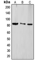 GRG4 / TLE4 Antibody - Western blot analysis of TLE4 expression in HeLa (A); Jurkat (B); HEK293T (C) whole cell lysates.