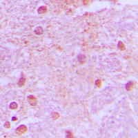 GRG4 / TLE4 Antibody - Immunohistochemical analysis of TLE4 staining in human brain formalin fixed paraffin embedded tissue section. The section was pre-treated using heat mediated antigen retrieval with sodium citrate buffer (pH 6.0). The section was then incubated with the antibody at room temperature and detected using an HRP conjugated compact polymer system. DAB was used as the chromogen. The section was then counterstained with hematoxylin and mounted with DPX.