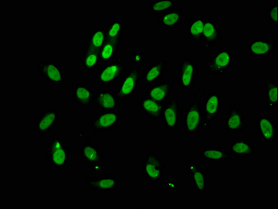 GRG4 / TLE4 Antibody - Immunofluorescence staining of Hela cells at a dilution of 1:100, counter-stained with DAPI. The cells were fixed in 4% formaldehyde, permeabilized using 0.2% Triton X-100 and blocked in 10% normal Goat Serum. The cells were then incubated with the antibody overnight at 4 °C.The secondary antibody was Alexa Fluor 488-congugated AffiniPure Goat Anti-Rabbit IgG (H+L) .