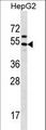 GRHL1 / TFCP2L2 Antibody - GRHL1 Antibody western blot of HepG2 cell line lysates (35 ug/lane). The GRHL1 antibody detected the GRHL1 protein (arrow).
