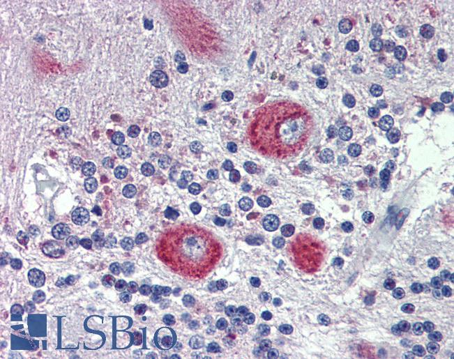 GRHL2 Antibody - Anti-GRHL2 antibody IHC of human brain, cerebellum. Immunohistochemistry of formalin-fixed, paraffin-embedded tissue after heat-induced antigen retrieval. Antibody concentration 5 ug/ml.  This image was taken for the unconjugated form of this product. Other forms have not been tested.