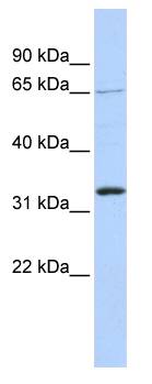 GRHL2 Antibody - Western blot of 721_B cell lysate.  This image was taken for the unconjugated form of this product. Other forms have not been tested.