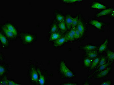 GRHL2 Antibody - Immunofluorescent analysis of Hela cells using GRHL2 Antibody at dilution of 1:100 and Alexa Fluor 488-congugated AffiniPure Goat Anti-Rabbit IgG(H+L)