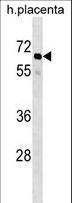 GRHL3 Antibody - GRHL3 Antibody western blot of human placenta tissue lysates (35 ug/lane). The GRHL3 antibody detected the GRHL3 protein (arrow).