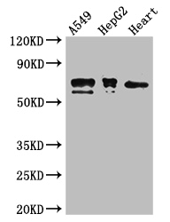 GRHL3 Antibody - Positive WB detected in:A549 whole cell lysate,HepG2 whole cell lysate,Mouse heart tissue;All lanes:GRHL3 antibody at 2.8ug/ml;Secondary;Goat polyclonal to rabbit IgG at 1/50000 dilution;Predicted band size: 71,69,63,58,68 kDa;Observed band size: 71,69 kDa;