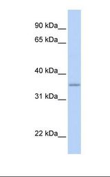 GRHPR / Glyoxylate Reductase Antibody - Fetal liver lysate. Antibody concentration: 1.0 ug/ml. Gel concentration: 12%.  This image was taken for the unconjugated form of this product. Other forms have not been tested.