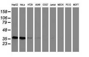 GRHPR / Glyoxylate Reductase Antibody - Western blot of extracts (35ug) from 9 different cell lines by using anti-GRHPR monoclonal antibody.