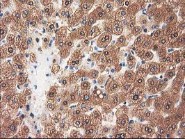 GRHPR / Glyoxylate Reductase Antibody - IHC of paraffin-embedded Human liver tissue using anti-GRHPR mouse monoclonal antibody.
