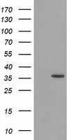 GRHPR / Glyoxylate Reductase Antibody - HEK293T cells were transfected with the pCMV6-ENTRY control (Left lane) or pCMV6-ENTRY GRHPR (Right lane) cDNA for 48 hrs and lysed. Equivalent amounts of cell lysates (5 ug per lane) were separated by SDS-PAGE and immunoblotted with anti-GRHPR.