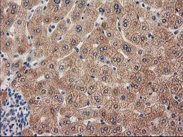 GRHPR / Glyoxylate Reductase Antibody - IHC of paraffin-embedded Human liver tissue using anti-GRHPR mouse monoclonal antibody. (Heat-induced epitope retrieval by 10mM citric buffer, pH6.0, 100C for 10min).