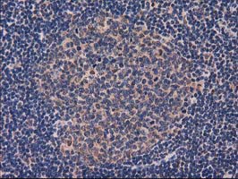 GRHPR / Glyoxylate Reductase Antibody - IHC of paraffin-embedded Human lymph node tissue using anti-GRHPR mouse monoclonal antibody. (Heat-induced epitope retrieval by 10mM citric buffer, pH6.0, 100C for 10min).