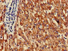 GRHPR / Glyoxylate Reductase Antibody - Immunohistochemistry of paraffin-embedded human liver tissue at dilution of 1:100