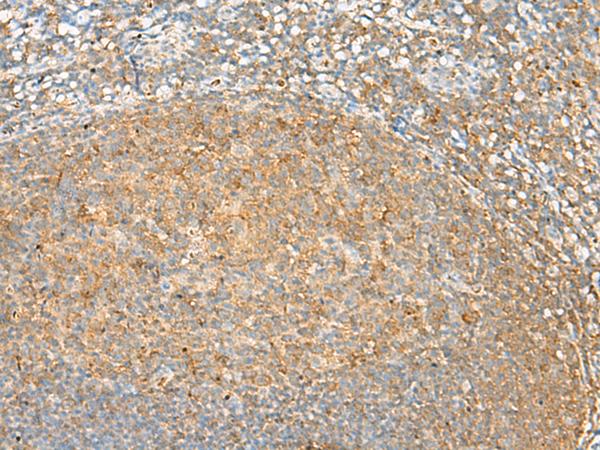 GRHPR / Glyoxylate Reductase Antibody - Immunohistochemistry of paraffin-embedded Human tonsil tissue  using GRHPR Polyclonal Antibody at dilution of 1:30(×200)