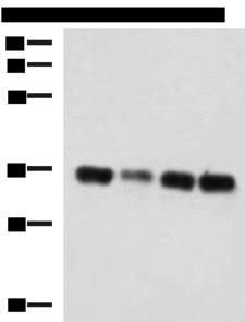 GRHPR / Glyoxylate Reductase Antibody - Western blot analysis of 293T cell lysates  using GRHPR Polyclonal Antibody at dilution of 1:750