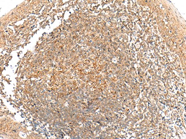 GRHPR / Glyoxylate Reductase Antibody - Immunohistochemistry of paraffin-embedded Human tonsil tissue  using GRHPR Polyclonal Antibody at dilution of 1:35(×200)