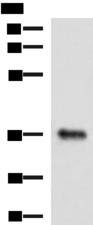 GRHPR / Glyoxylate Reductase Antibody - Western blot analysis of Mouse liver tissue lysate  using GRHPR Polyclonal Antibody at dilution of 1:900