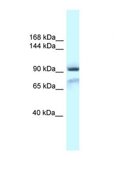 GRIA1 / GLUR1 Antibody - GRIA1 / GLUR1 antibody Western blot of Mouse Pancreas lysate. Antibody concentration 1 ug/ml.  This image was taken for the unconjugated form of this product. Other forms have not been tested.