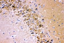 GRIA1 / GLUR1 Antibody - GRIA1 antibody IHC-paraffin: Rat Brain Tissue.