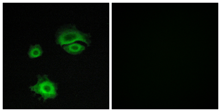 GRIA1 / GLUR1 Antibody - Immunofluorescence analysis of A549 cells, using GluR1 Antibody. The picture on the right is blocked with the synthesized peptide.