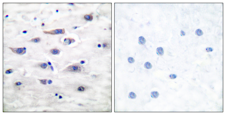 GRIA1 / GLUR1 Antibody - Immunohistochemistry analysis of paraffin-embedded human brain tissue, using GluR1 Antibody. The picture on the right is blocked with the synthesized peptide.