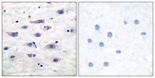 GRIA1 / GLUR1 Antibody - Immunohistochemistry analysis of paraffin-embedded human brain tissue, using GluR1 Antibody. The picture on the right is blocked with the synthesized peptide.