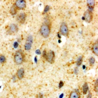 GRIA1 / GLUR1 Antibody - Immunohistochemical analysis of GLUR1 staining in human brain formalin fixed paraffin embedded tissue section. The section was pre-treated using heat mediated antigen retrieval with sodium citrate buffer (pH 6.0). The section was then incubated with the antibody at room temperature and detected using an HRP polymer system. DAB was used as the chromogen. The section was then counterstained with hematoxylin and mounted with DPX.