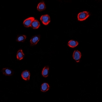 GRIA1 / GLUR1 Antibody - Immunofluorescent analysis of GLUR1 staining in A549 cells. Formalin-fixed cells were permeabilized with 0.1% Triton X-100 in TBS for 5-10 minutes and blocked with 3% BSA-PBS for 30 minutes at room temperature. Cells were probed with the primary antibody in 3% BSA-PBS and incubated overnight at 4 deg C in a humidified chamber. Cells were washed with PBST and incubated with a DyLight 594-conjugated secondary antibody (red) in PBS at room temperature in the dark. DAPI was used to stain the cell nuclei (blue).