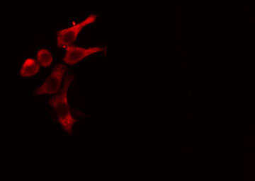 GRIA1 / GLUR1 Antibody - Staining COLO205 cells by IF/ICC. The samples were fixed with PFA and permeabilized in 0.1% Triton X-100, then blocked in 10% serum for 45 min at 25°C. The primary antibody was diluted at 1:200 and incubated with the sample for 1 hour at 37°C. An Alexa Fluor 594 conjugated goat anti-rabbit IgG (H+L) antibody, diluted at 1/600, was used as secondary antibody.