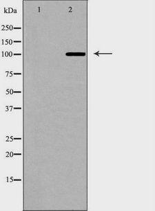 GRIA1 / GLUR1 Antibody - Western blot analysis of extracts of rat brain tissue using GRIA1 antibody. The lane on the left is treated with the antigen-specific peptide.