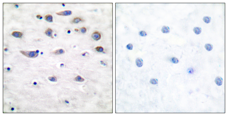 GRIA1 / GLUR1 Antibody - Immunohistochemistry analysis of paraffin-embedded human brain, using GluR1 (Phospho-Ser849) Antibody. The picture on the right is blocked with the phospho peptide.