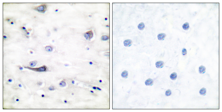 GRIA1 / GLUR1 Antibody - Immunohistochemistry analysis of paraffin-embedded human brain, using GluR1 (Phospho-Ser863) Antibody. The picture on the right is blocked with the phospho peptide.