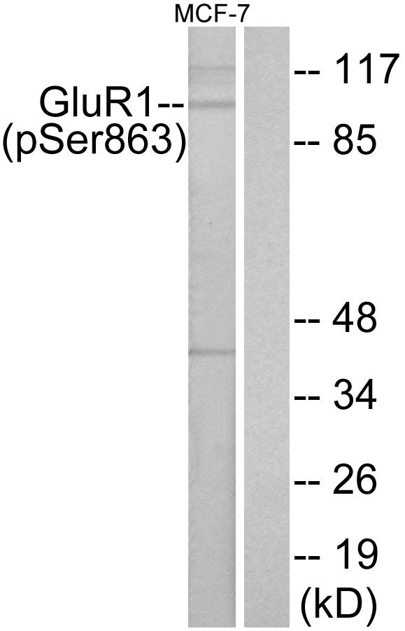 GRIA1 / GLUR1 Antibody - Western blot analysis of lysates from MCF-7 cells, using GluR1 (Phospho-Ser863) Antibody. The lane on the right is blocked with the phospho peptide.