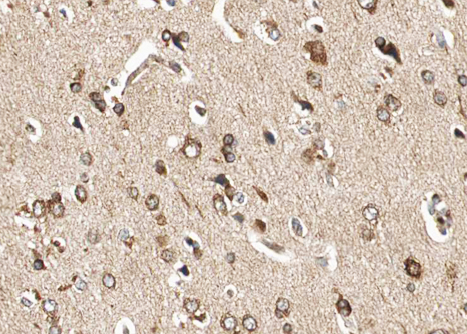GRIA1 / GLUR1 Antibody - 1:100 staining human brain tissue by IHC-P. The tissue was formaldehyde fixed and a heat mediated antigen retrieval step in citrate buffer was performed. The tissue was then blocked and incubated with the antibody for 1.5 hours at 22°C. An HRP conjugated goat anti-rabbit antibody was used as the secondary.