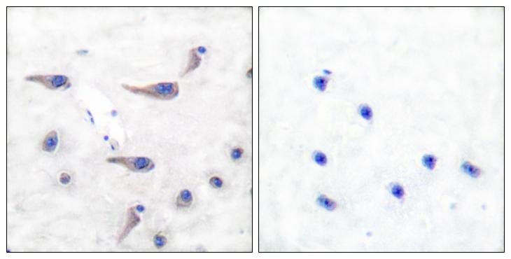 GRIA1 / GLUR1 Antibody - P-peptide - + Immunohistochemical analysis of paraffin-embedded human brain tissue using GluR1 (phospho-Ser863) antibody.