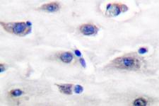 GRIA1 / GLUR1 Antibody - IHC of GluR1 (S857) pAb in paraffin-embedded human brain tissue.