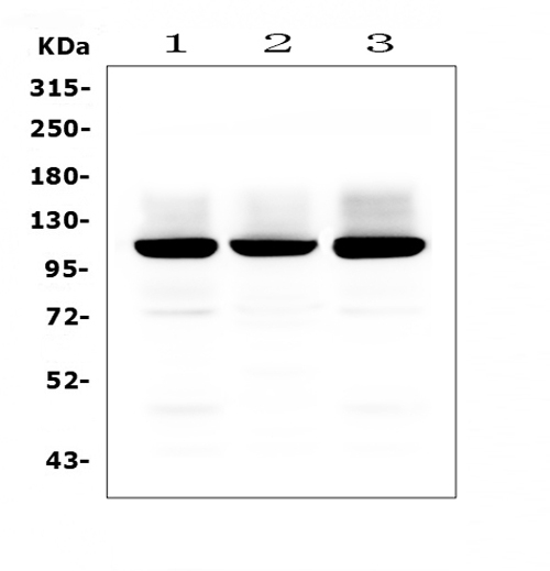 GRIA2 / GLUR2 Antibody - Western blot analysis of GRIA2 using anti-GRIA2 antibody. Electrophoresis was performed on a 5-20% SDS-PAGE gel at 70V (Stacking gel) / 90V (Resolving gel) for 2-3 hours. The sample well of each lane was loaded with 50ug of sample under reducing conditions. Lane 1: rat brain tissue lysates, Lane 2: rat C6 whole cell lysates, Lane 3: mouse brain tissue lysates. After Electrophoresis, proteins were transferred to a Nitrocellulose membrane at 150mA for 50-90 minutes. Blocked the membrane with 5% Non-fat Milk/ TBS for 1.5 hour at RT. The membrane was incubated with rabbit anti-GRIA2 antigen affinity purified polyclonal antibody at 0.5 µg/mL overnight at 4°C, then washed with TBS-0.1% Tween 3 times with 5 minutes each and probed with a goat anti-rabbit IgG-HRP secondary antibody at a dilution of 1:10000 for 1.5 hour at RT. The signal is developed using an Enhanced Chemiluminescent detection (ECL) kit with Tanon 5200 system. A specific band was detected for GRIA2 at approximately 110KD. The expected band size for GRIA2 is at 99KD.
