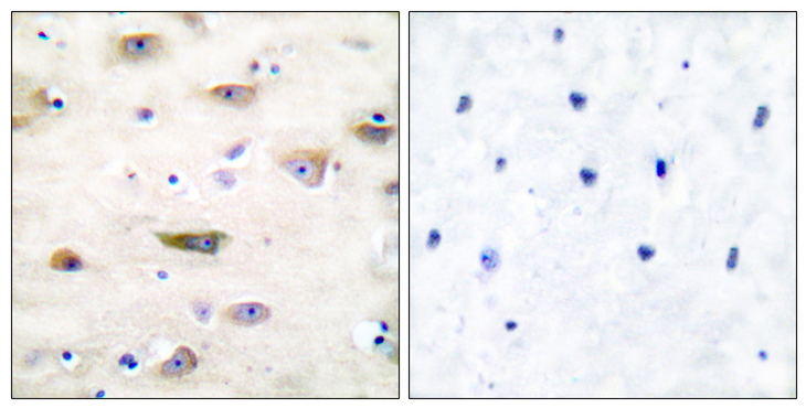 GRIA2 / GLUR2 Antibody - Immunohistochemistry analysis of paraffin-embedded human brain tissue, using GluR2 Antibody. The picture on the right is blocked with the synthesized peptide.