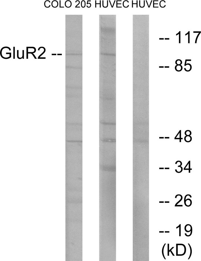 GRIA2 / GLUR2 Antibody - Western blot analysis of lysates from COLO205 and HUVEC cells, using GluR2 Antibody. The lane on the right is blocked with the synthesized peptide.