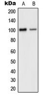 GRIA2 / GLUR2 Antibody - Western blot analysis of GLUR2 expression in human brain (A); mouse cortex (B) whole cell lysates.