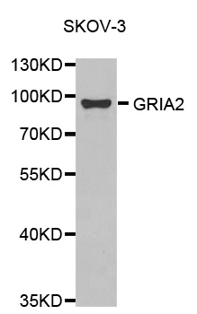GRIA2 / GLUR2 Antibody - Western blot analysis of extracts of SKOV-3 cell line, using GRIA2 antibody.